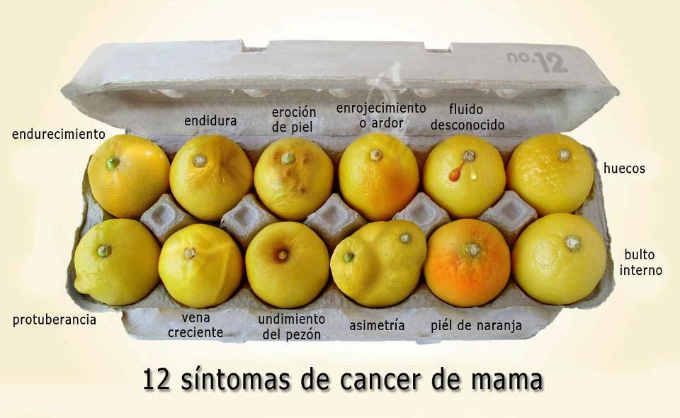 12 síntomas cáncer de mama